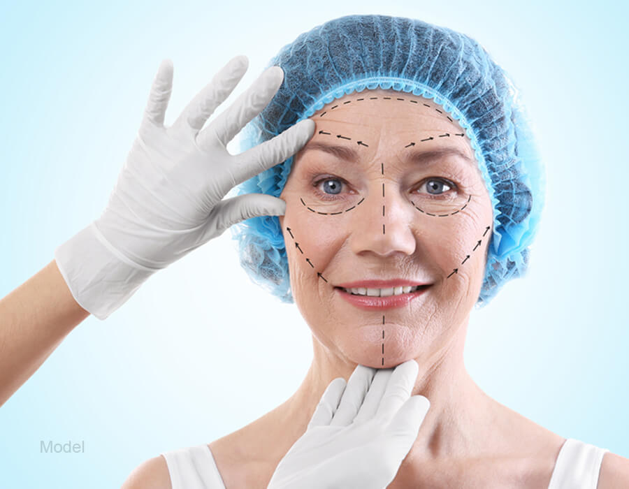 Facelift Surgery