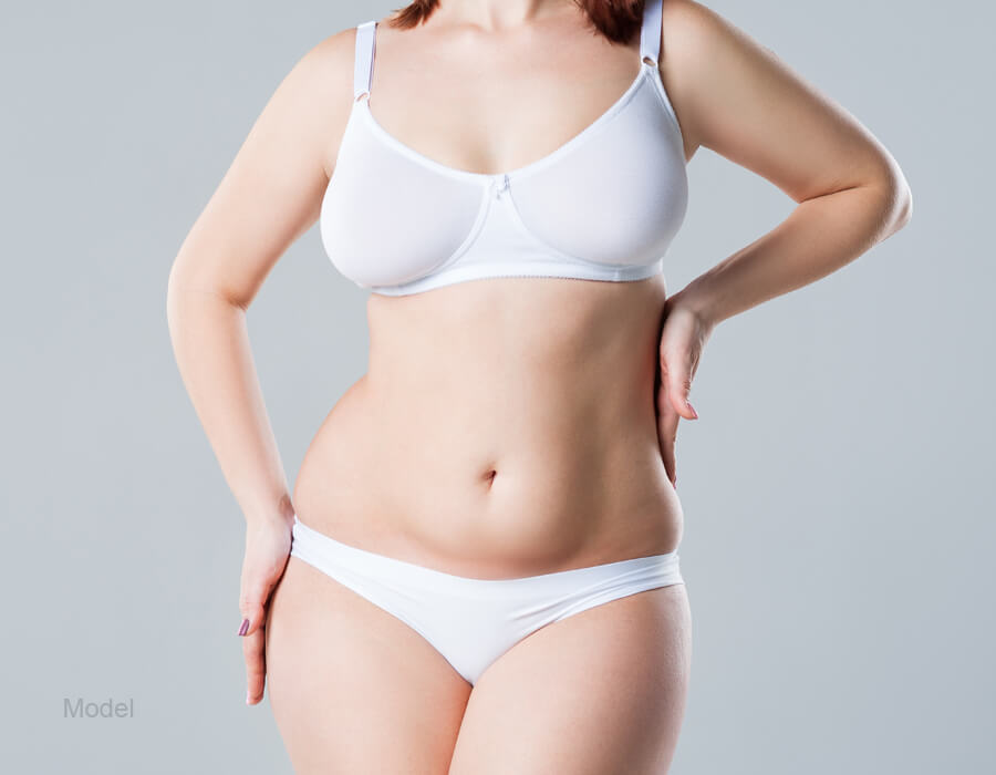 Tummy Tuck